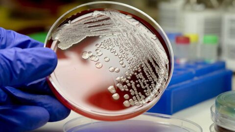 meningitis bacteriana