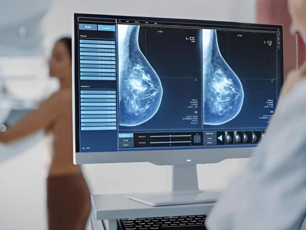 mamografia